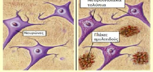 kainotoma-aimatologiki-exetasi-gia-tin-egkairi-diagnosi-tis-nosou-Alzheimer